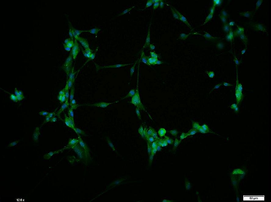 Tissue/cell: U-87MG cell; 4% Paraformaldehyde-fixed; Triton X-100 at room temperature for 20 min; Blocking buffer (normal goat serum) at 37°C for 20 min; Antibody incubation with LILRB2 Polyclonal Antibody, Unconjugated (bs-7349R) 1:100, 90 minutes at 37°C; followed by a conjugated Goat Anti-Rabbit IgG antibody (bs-0295G-FITC) at 37°C for 90 minutes, DAPI (5ug/ml, blue) was used to stain the cell nuclei. Tissue/cell: U-87MG cell; 4% Paraformaldehyde-fixed; Triton X-100 at room temperature for 20 min; Blocking buffer (normal goat serum) at 37°C for 20 min; Antibody incubation with LILRB2 Polyclonal Antibody, Unconjugated (bs-7349R) 1:100, 90 minutes at 37°C; followed by a conjugated Goat Anti-Rabbit IgG antibody (bs-0295G-FITC) at 37°C for 90 minutes, DAPI (5ug/ml, blue) was used to stain the cell nuclei.
