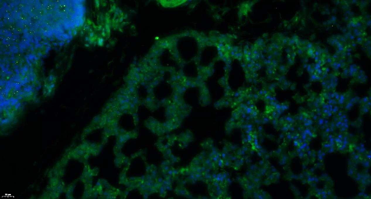 Paraformaldehyde-fixed, paraffin embedded Rat lung; Antigen retrieval by boiling in sodium citrate buffer (pH6.0) for 15min; Blocking buffer (normal goat serum) at 37°C for 30min; Antibody incubation with Insulin Receptor alpha Polyclonal Antibody, Unconjugated (bs-0047R) at 1:200 overnight at 4°C, followed by a conjugated Goat Anti-Rabbit IgG antibody (bs-0295G-FITC) for 90 minutes, and DAPI for nuclei staining.