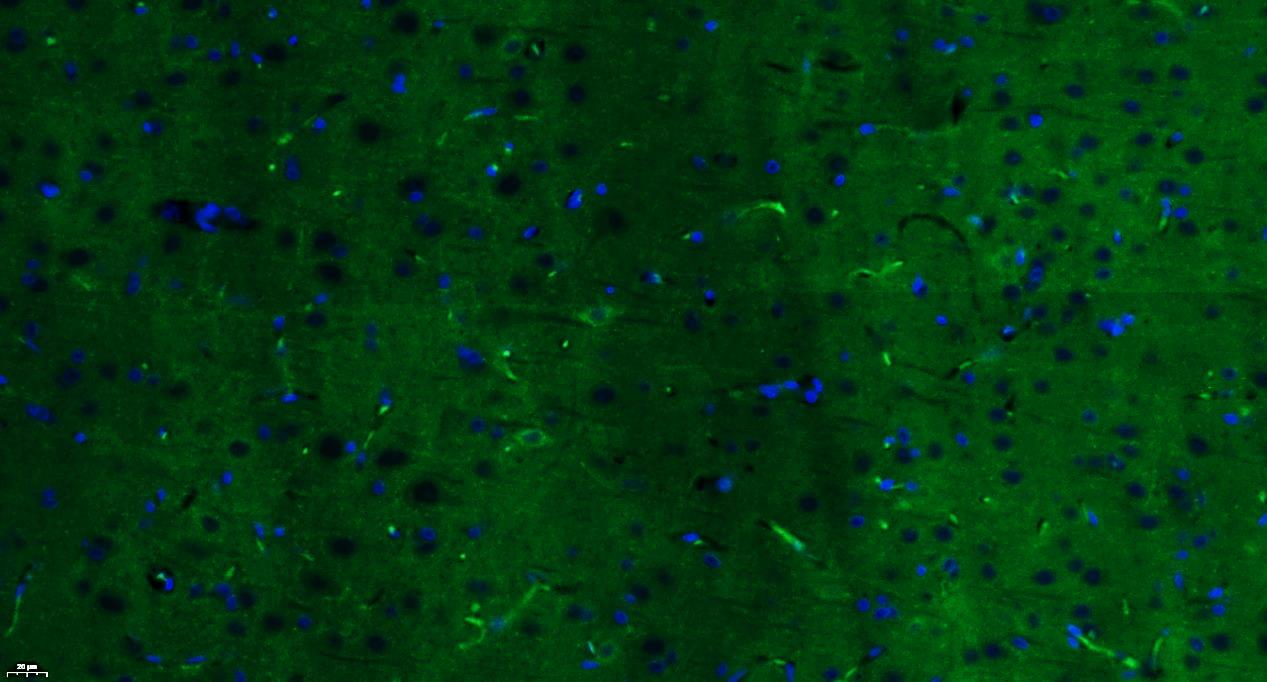 Paraformaldehyde-fixed, paraffin embedded Rat brain; Antigen retrieval by boiling in sodium citrate buffer (pH6.0) for 15min; Blocking buffer (normal goat serum) at 37°C for 30min; Antibody incubation with Insulin Receptor alpha Polyclonal Antibody, Unconjugated (bs-0047R) at 1:200 overnight at 4°C, followed by a conjugated Goat Anti-Rabbit IgG antibody (bs-0295G-FITC) for 90 minutes, and DAPI for nuclei staining.