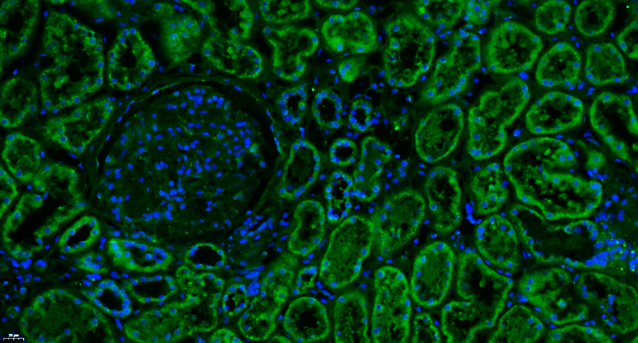 Paraformaldehyde-fixed, paraffin embedded Human kidney; Antigen retrieval by boiling in sodium citrate buffer (pH6.0) for 15min; Blocking buffer (normal goat serum) at 37°C for 30min; Antibody incubation with Complement C3d fragment Polyclonal Antibody, Unconjugated (bs-4877R) at 1:100 overnight at 4°C, followed by a conjugated Goat Anti-Rabbit IgG antibody (bs-0295G-FITC) for 90 minutes, and DAPI for nuclei staining.