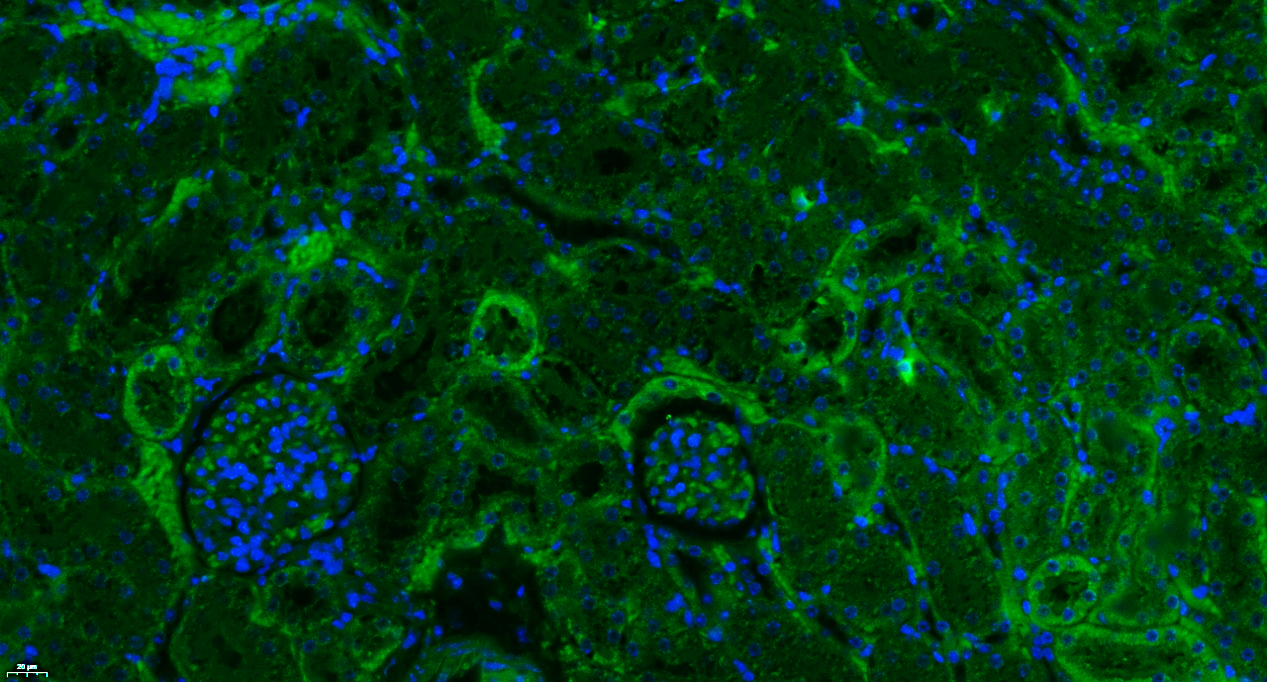 Paraformaldehyde-fixed, paraffin embedded Mouse kidney; Antigen retrieval by boiling in sodium citrate buffer (pH6.0) for 15min; Blocking buffer (normal goat serum) at 37°C for 30min; Antibody incubation with Properdin Polyclonal Antibody, Unconjugated (bs-8306R) at 1:100 overnight at 4°C, followed by a conjugated Goat Anti-Rabbit IgG antibody (bs-0295G-FITC) for 90 minutes, and DAPI for nuclei staining.
