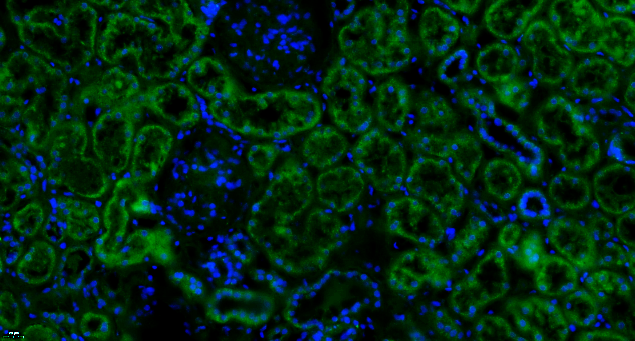 Paraformaldehyde-fixed, paraffin embedded Human kidney; Antigen retrieval by boiling in sodium citrate buffer (pH6.0) for 15min; Blocking buffer (normal goat serum) at 37°C for 30min; Antibody incubation with Properdin Polyclonal Antibody, Unconjugated (bs-8306R) at 1:100 overnight at 4°C, followed by a conjugated Goat Anti-Rabbit IgG antibody (bs-0295G-FITC) for 90 minutes, and DAPI for nuclei staining.