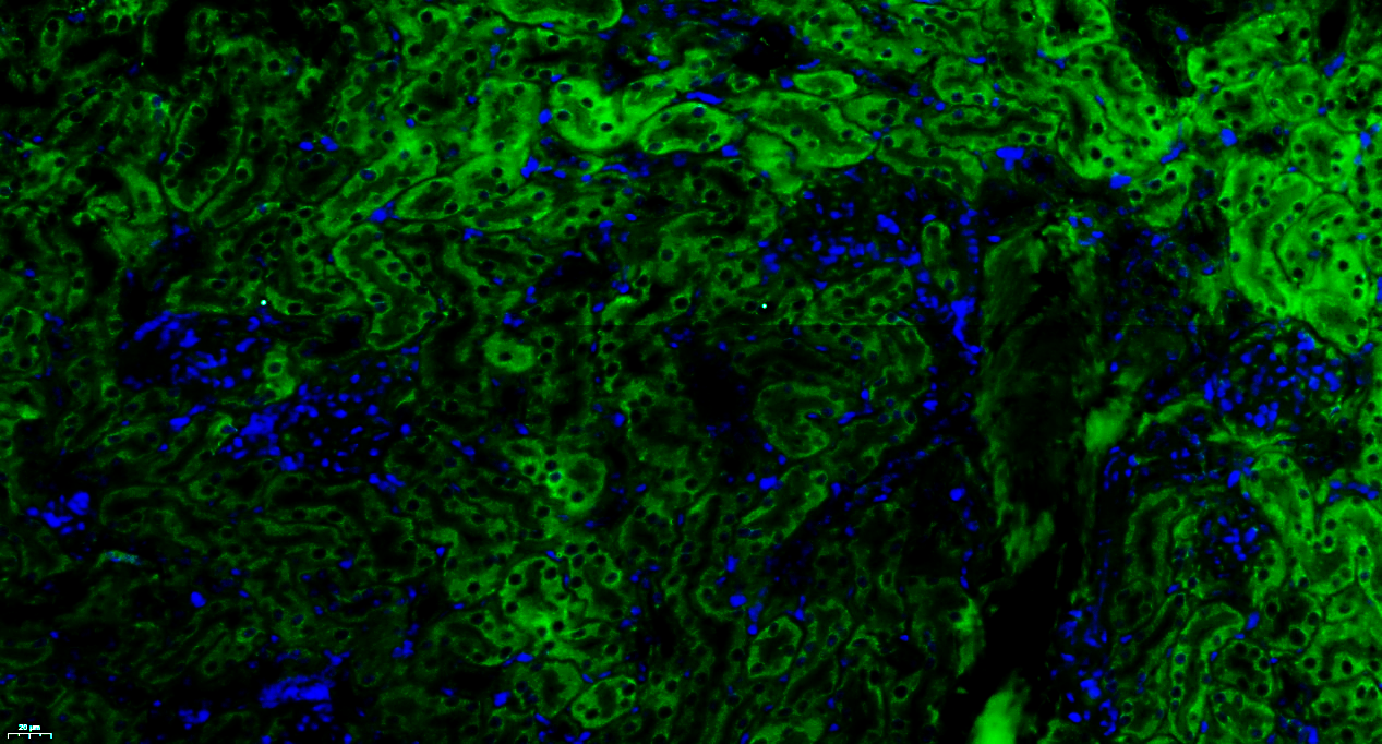 Paraformaldehyde-fixed, paraffin embedded Mouse kidney; Antigen retrieval by boiling in sodium citrate buffer (pH6.0) for 15min; Blocking buffer (normal goat serum) at 37°C for 30min; Antibody incubation with Factor H Polyclonal Antibody, Unconjugated (bs-9525R) at 1:100 overnight at 4°C, followed by a conjugated Goat Anti-Rabbit IgG antibody (bs-0295G-FITC) for 90 minutes, and DAPI for nuclei staining.