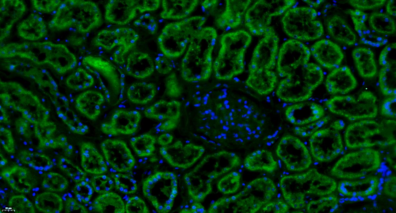 Paraformaldehyde-fixed, paraffin embedded Human kidney; Antigen retrieval by boiling in sodium citrate buffer (pH6.0) for 15min; Blocking buffer (normal goat serum) at 37°C for 30min; Antibody incubation with Factor H Polyclonal Antibody, Unconjugated (bs-9525R) at 1:100 overnight at 4°C, followed by a conjugated Goat Anti-Rabbit IgG antibody (bs-0295G-FITC) for 90 minutes, and DAPI for nuclei staining.