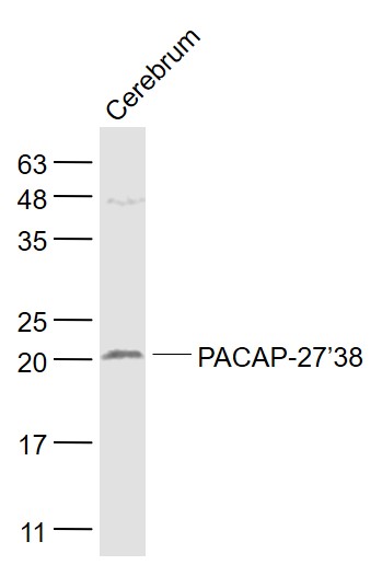 Rat cerebrum lysates probed with PACAP-27/38 Polyclonal Antibody, Unconjugated (bs-0190R) at 1:1000 dilution and 4˚C overnight incubation. Followed by conjugated secondary antibody incubation at 1:20000 for 60 min at 37˚C.