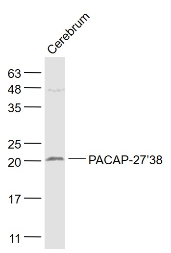Rat cerebrum lysates probed with PACAP-27\/38 Polyclonal Antibody, Unconjugated (bs-0190R) at 1:1000 dilution and 4˚C overnight incubation. Followed by conjugated secondary antibody incubation at 1:20000 for 60 min at 37˚C.