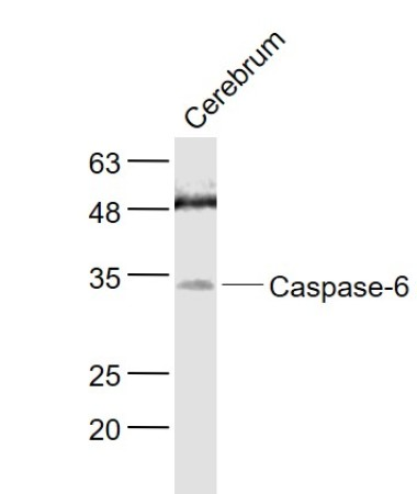 Rat cerebrum lysates probed with Caspase-6 subunit p11 Polyclonal Antibody, Unconjugated (bs-10135R) at 1:1000 dilution and 4˚C overnight incubation. Followed by conjugated secondary antibody incubation at 1:20000 for 60 min at 37˚C.