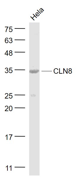 Hela cell lysates probed with CLN8 Polyclonal Antibody, Unconjugated (bs-11715R) at 1:1000 dilution and 4˚C overnight incubation. Followed by conjugated secondary antibody incubation at 1:20000 for 60 min at 37˚C.