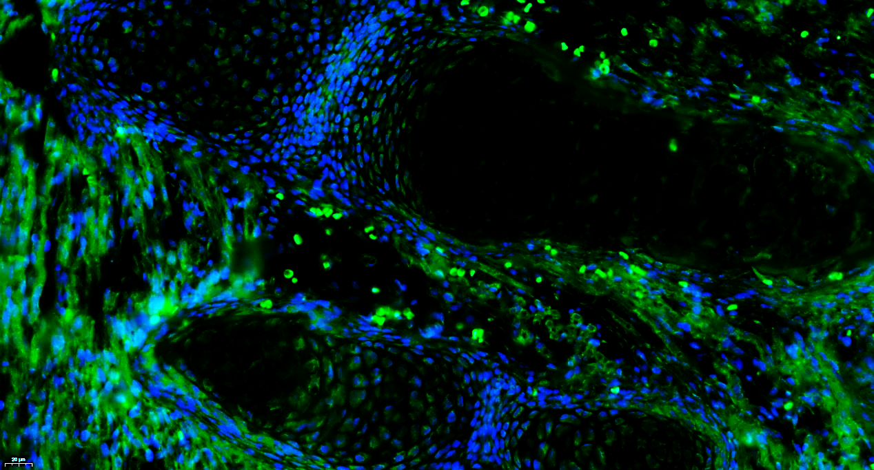Paraformaldehyde-fixed, paraffin embedded Mouse Embryo; Antigen retrieval by boiling in sodium citrate buffer (pH6.0) for 15min; Blocking buffer (normal goat serum) at 37°C for 30min; Antibody incubation with CD133 Polyclonal Antibody, Unconjugated (bs-4770R) at 1:100 overnight at 4°C, followed by a conjugated Goat Anti-Rabbit IgG antibody (bs-0295G-FITC) for 90 minutes, and DAPI for nuclei staining. Paraformaldehyde-fixed, paraffin embedded Mouse Embryo; Antigen retrieval by boiling in sodium citrate buffer (pH6.0) for 15min; Blocking buffer (normal goat serum) at 37°C for 30min; Antibody incubation with CD133 Polyclonal Antibody, Unconjugated (bs-4770R) at 1:100 overnight at 4°C, followed by a conjugated Goat Anti-Rabbit IgG antibody (bs-0295G-FITC) for 90 minutes, and DAPI for nuclei staining.
