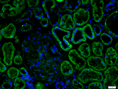Paraformaldehyde-fixed, paraffin embedded Human kidney; Antigen retrieval by boiling in sodium citrate buffer (pH6.0) for 15min; Block endogenous peroxidase by 3% hydrogen peroxide for 20 minutes; Blocking buffer (normal goat serum) at 37°C for 30min; Incubation: Anti-beta Defensin 3 Antibody, conjugated (bs-7378R-FITC) at a 1:100 dilution, for 1.5 hours at 37°C; DAPI (5ug/ml, blue) was used to stain the cell nuclei. Paraformaldehyde-fixed, paraffin embedded Human kidney; Antigen retrieval by boiling in sodium citrate buffer (pH6.0) for 15min; Block endogenous peroxidase by 3% hydrogen peroxide for 20 minutes; Blocking buffer (normal goat serum) at 37°C for 30min; Incubation: Anti-beta Defensin 3 Antibody, conjugated (bs-7378R-FITC) at a 1:100 dilution, for 1.5 hours at 37°C; DAPI (5ug/ml, blue) was used to stain the cell nuclei.