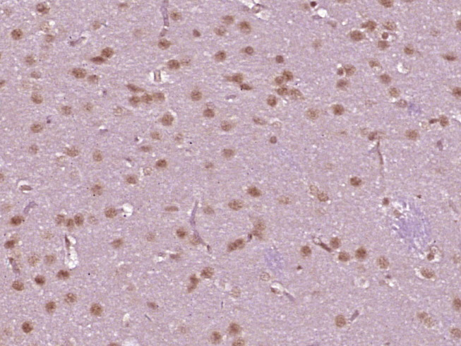 Paraformaldehyde-fixed, paraffin embedded Rat brain; Antigen retrieval by boiling in sodium citrate buffer (pH6.0) for 15min; Block endogenous peroxidase by 3% hydrogen peroxide for 20 minutes; Blocking buffer (normal goat serum) at 37°C for 30min; Antibody incubation with CDC25A/B/C Polyclonal Antibody, Unconjugated (bs-10579R) at 1:400 overnight at 4°C, DAB staining.