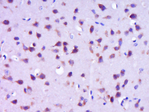 Paraformaldehyde-fixed, paraffin embedded Mouse brain; Antigen retrieval by boiling in sodium citrate buffer (pH6.0) for 15min; Block endogenous peroxidase by 3% hydrogen peroxide for 20 minutes; Blocking buffer (normal goat serum) at 37°C for 30min; Antibody incubation with NELL1 Polyclonal Antibody, Unconjugated (bs-10704R) at 1:400 overnight at 4°C, DAB staining.