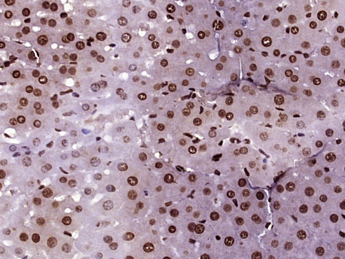 Paraformaldehyde-fixed, paraffin embedded Rat liver; Antigen retrieval by boiling in sodium citrate buffer (pH6.0) for 15min; Block endogenous peroxidase by 3% hydrogen peroxide for 20 minutes; Blocking buffer (normal goat serum) at 37°C for 30min; Antibody incubation with Histone H4 (Acetyl K5) Polyclonal Antibody, Unconjugated (bs-10721R) at 1:400 overnight at 4°C, DAB staining.