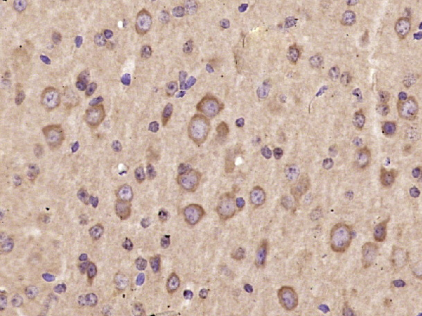 Paraformaldehyde-fixed, paraffin embedded Mouse brain; Antigen retrieval by boiling in sodium citrate buffer (pH6.0) for 15min; Block endogenous peroxidase by 3% hydrogen peroxide for 20 minutes; Blocking buffer (normal goat serum) at 37°C for 30min; Antibody incubation with AKT2 Polyclonal Antibody, Unconjugated (bs-10724R) at 1:400 overnight at 4°C, DAB staining.