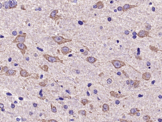 Paraformaldehyde-fixed, paraffin embedded Rat brain; Antigen retrieval by boiling in sodium citrate buffer (pH6.0) for 15min; Block endogenous peroxidase by 3% hydrogen peroxide for 20 minutes; Blocking buffer (normal goat serum) at 37°C for 30min; Antibody incubation with AKT2 Polyclonal Antibody, Unconjugated (bs-10724R) at 1:400 overnight at 4°C, DAB staining.