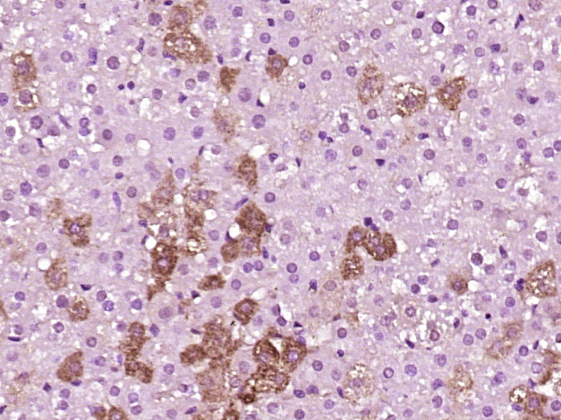 Paraformaldehyde-fixed, paraffin embedded Rat liver; Antigen retrieval by boiling in sodium citrate buffer (pH6.0) for 15min; Block endogenous peroxidase by 3% hydrogen peroxide for 20 minutes; Blocking buffer (normal goat serum) at 37°C for 30min; Antibody incubation with PLEKHG5 Polyclonal Antibody, Unconjugated (bs-12455R) at 1:400 overnight at 4°C, DAB staining.