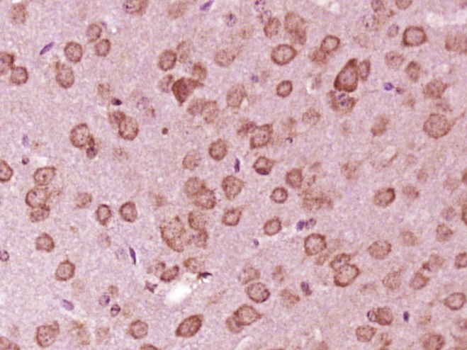 Paraformaldehyde-fixed, paraffin embedded Mouse brain; Antigen retrieval by boiling in sodium citrate buffer (pH6.0) for 15min; Block endogenous peroxidase by 3% hydrogen peroxide for 20 minutes; Blocking buffer (normal goat serum) at 37°C for 30min; Antibody incubation with PLEKHG5 Polyclonal Antibody, Unconjugated (bs-12455R) at 1:400 overnight at 4°C, DAB staining.