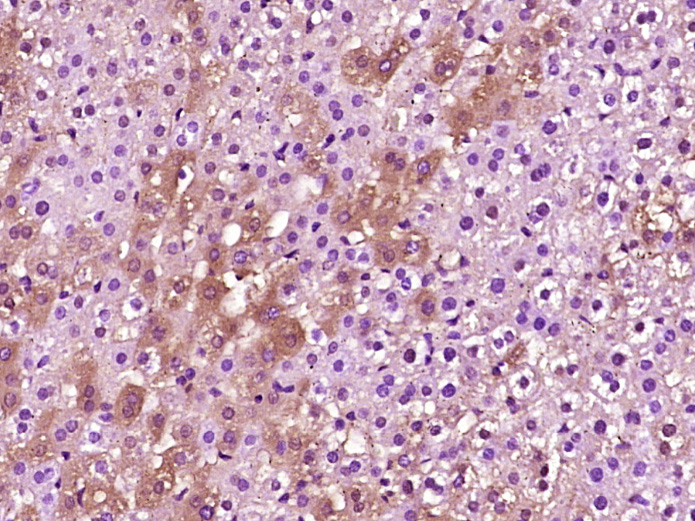 Paraformaldehyde-fixed, paraffin embedded Rat liver; Antigen retrieval by boiling in sodium citrate buffer (pH6.0) for 15min; Block endogenous peroxidase by 3% hydrogen peroxide for 20 minutes; Blocking buffer (normal goat serum) at 37°C for 30min; Antibody incubation with PEX14 Polyclonal Antibody, Unconjugated (bs-12621R) at 1:400 overnight at 4°C, DAB staining.