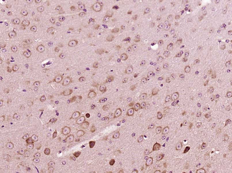 Paraformaldehyde-fixed, paraffin embedded Mouse brain; Antigen retrieval by boiling in sodium citrate buffer (pH6.0) for 15min; Block endogenous peroxidase by 3% hydrogen peroxide for 20 minutes; Blocking buffer (normal goat serum) at 37°C for 30min; Antibody incubation with PEX5 Polyclonal Antibody, Unconjugated (bs-12624R) at 1:400 overnight at 4°C, DAB staining.