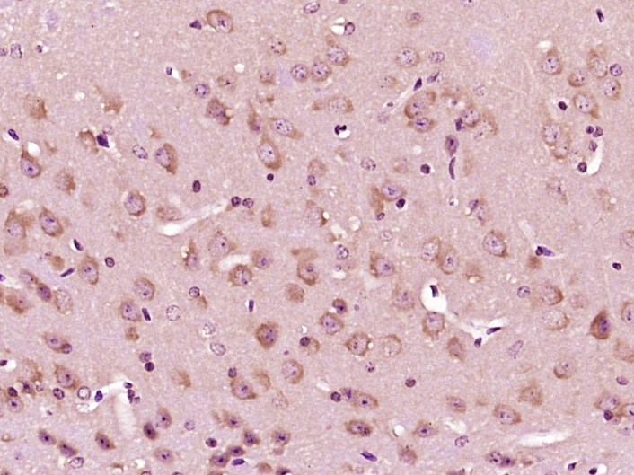 Paraformaldehyde-fixed, paraffin embedded Mouse brain; Antigen retrieval by boiling in sodium citrate buffer (pH6.0) for 15min; Block endogenous peroxidase by 3% hydrogen peroxide for 20 minutes; Blocking buffer (normal goat serum) at 37°C for 30min; Antibody incubation with SMEK1 Polyclonal Antibody, Unconjugated (bs-12636R) at 1:400 overnight at 4°C, DAB staining.