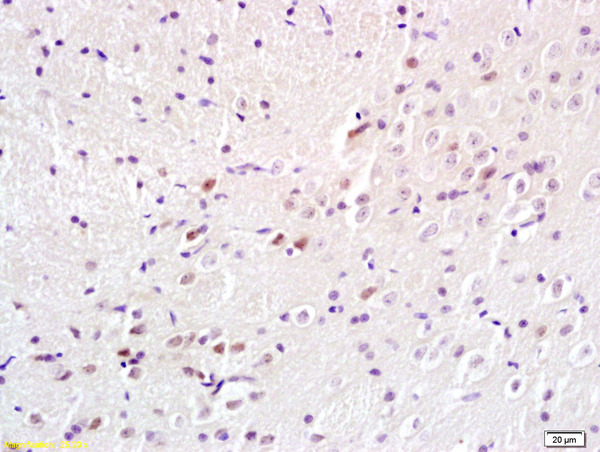 Formalin-fixed and paraffin embedded rat brain labeled with Anti-BS69/Adenovirus 5 E1A binding protein Polyclonal Antibody, Unconjugated (bs-7697R) at 1:200 followed by conjugation to the secondary antibody and DAB staining.