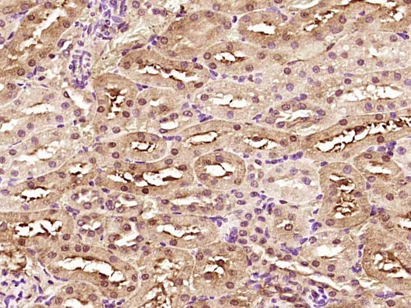 Paraformaldehyde-fixed, paraffin embedded Rat kidney; Antigen retrieval by boiling in sodium citrate buffer (pH6.0) for 15min; Block endogenous peroxidase by 3% hydrogen peroxide for 20 minutes; Blocking buffer (normal goat serum) at 37°C for 30min; Antibody incubation with SMYD5 Polyclonal Antibody, Unconjugated (bs-12648R) at 1:400 overnight at 4°C, DAB staining.