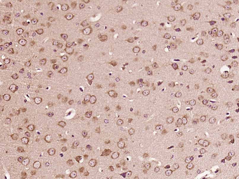 Paraformaldehyde-fixed, paraffin embedded Mouse brain; Antigen retrieval by boiling in sodium citrate buffer (pH6.0) for 15min; Block endogenous peroxidase by 3% hydrogen peroxide for 20 minutes; Blocking buffer (normal goat serum) at 37°C for 30min; Antibody incubation with B4GALNT1/GM2 synthase Polyclonal Antibody, Unconjugated (bs-12706R) at 1:400 overnight at 4°C, DAB staining.