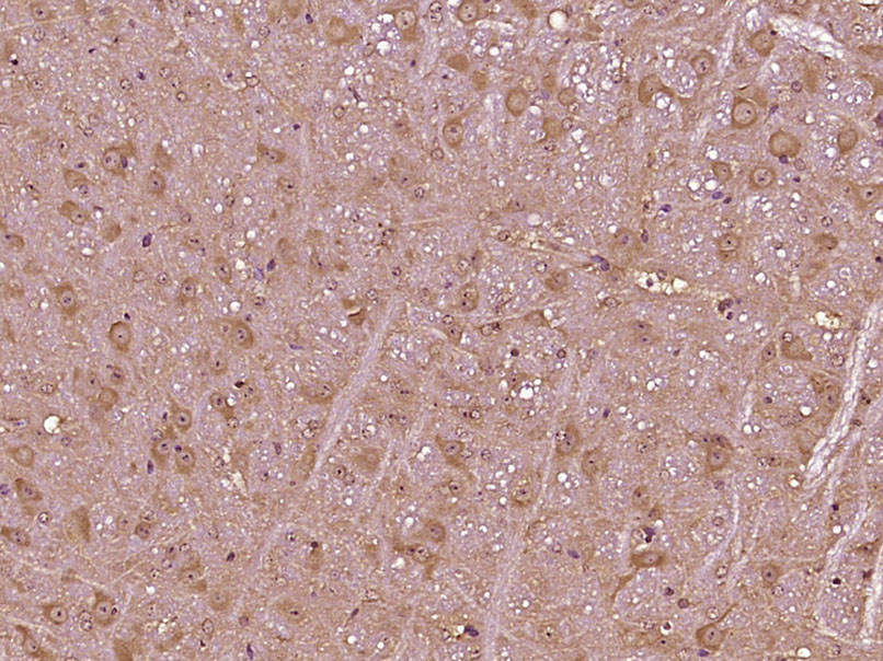 Paraformaldehyde-fixed, paraffin embedded Mouse brain; Antigen retrieval by boiling in sodium citrate buffer (pH6.0) for 15min; Block endogenous peroxidase by 3% hydrogen peroxide for 20 minutes; Blocking buffer (normal goat serum) at 37°C for 30min; Antibody incubation with VPS13D Polyclonal Antibody, Unconjugated (bs-12766R) at 1:400 overnight at 4°C, DAB staining.