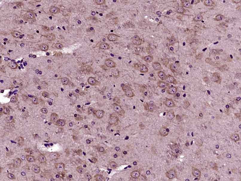 Paraformaldehyde-fixed, paraffin embedded Mouse brain; Antigen retrieval by boiling in sodium citrate buffer (pH6.0) for 15min; Block endogenous peroxidase by 3% hydrogen peroxide for 20 minutes; Blocking buffer (normal goat serum) at 37°C for 30min; Antibody incubation with VPS45 Polyclonal Antibody, Unconjugated (bs-12777R) at 1:400 overnight at 4°C, DAB staining.