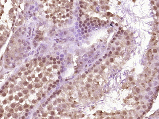 Paraformaldehyde-fixed, paraffin embedded Mouse testis; Antigen retrieval by boiling in sodium citrate buffer (pH6.0) for 15min; Block endogenous peroxidase by 3% hydrogen peroxide for 20 minutes; Blocking buffer (normal goat serum) at 37°C for 30min; Antibody incubation with VRTN Polyclonal Antibody, Unconjugated (bs-12781R) at 1:400 overnight at 4°C, DAB staining.