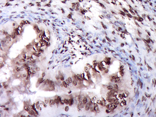 Paraformaldehyde-fixed, paraffin embedded Rat ovarian; Antigen retrieval by boiling in sodium citrate buffer (pH6.0) for 15min; Block endogenous peroxidase by 3% hydrogen peroxide for 20 minutes; Blocking buffer (normal goat serum) at 37°C for 30min; Antibody incubation with ZNF22 Polyclonal Antibody, Unconjugated (bs-12803R) at 1:400 overnight at 4°C, DAB staining.