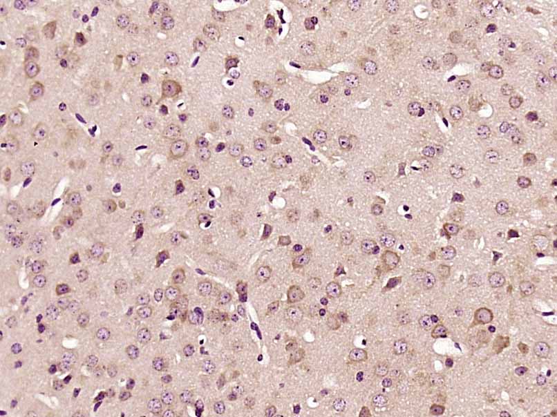 Paraformaldehyde-fixed, paraffin embedded Mouse brain; Antigen retrieval by boiling in sodium citrate buffer (pH6.0) for 15min; Block endogenous peroxidase by 3% hydrogen peroxide for 20 minutes; Blocking buffer (normal goat serum) at 37°C for 30min; Antibody incubation with PKC iota Polyclonal Antibody, Unconjugated (bs-12689R) at 1:400 overnight at 4°C, DAB staining.
