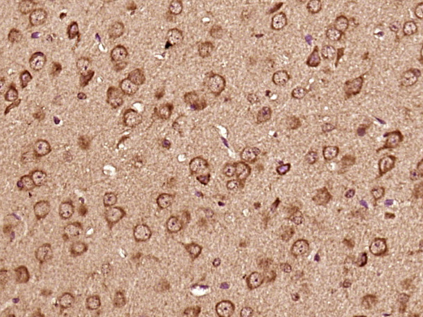 Paraformaldehyde-fixed, paraffin embedded Mouse brain; Antigen retrieval by boiling in sodium citrate buffer (pH6.0) for 15min; Block endogenous peroxidase by 3% hydrogen peroxide for 20 minutes; Blocking buffer (normal goat serum) at 37°C for 30min; Antibody incubation with CDC42EP3 Polyclonal Antibody, Unconjugated (bs-13759R) at 1:400 overnight at 4°C, DAB staining.