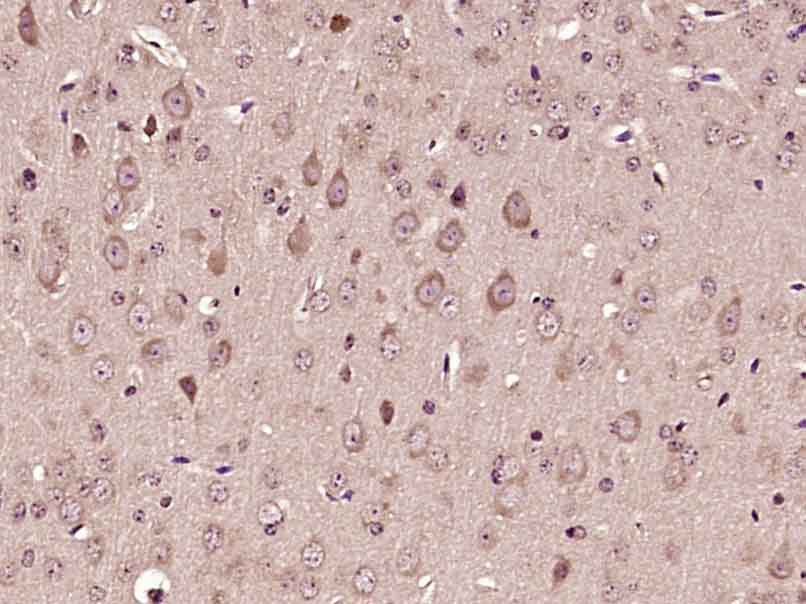 Paraformaldehyde-fixed, paraffin embedded Mouse brain; Antigen retrieval by boiling in sodium citrate buffer (pH6.0) for 15min; Block endogenous peroxidase by 3% hydrogen peroxide for 20 minutes; Blocking buffer (normal goat serum) at 37°C for 30min; Antibody incubation with COX6A1 Polyclonal Antibody, Unconjugated (bs-14007R) at 1:400 overnight at 4°C, DAB staining.