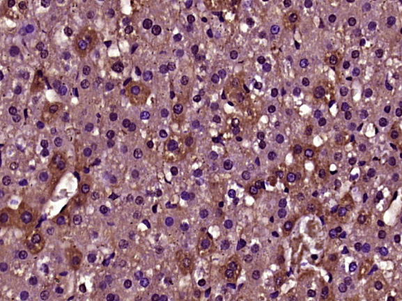 Paraformaldehyde-fixed, paraffin embedded Rat liver; Antigen retrieval by boiling in sodium citrate buffer (pH6.0) for 15min; Block endogenous peroxidase by 3% hydrogen peroxide for 20 minutes; Blocking buffer (normal goat serum) at 37°C for 30min; Antibody incubation with DENND1A Polyclonal Antibody, Unconjugated (bs-14269R) at 1:400 overnight at 4°C, DAB staining.