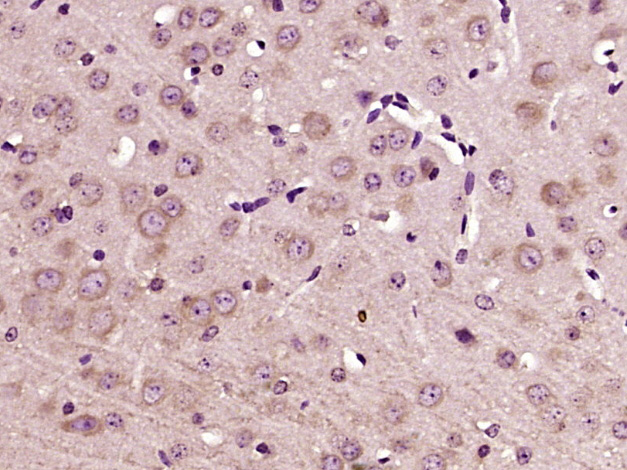 Paraformaldehyde-fixed, paraffin embedded Mouse brain; Antigen retrieval by boiling in sodium citrate buffer (pH6.0) for 15min; Block endogenous peroxidase by 3% hydrogen peroxide for 20 minutes; Blocking buffer (normal goat serum) at 37°C for 30min; Antibody incubation with DEXI Polyclonal Antibody, Unconjugated (bs-14283R) at 1:400 overnight at 4°C, DAB staining.