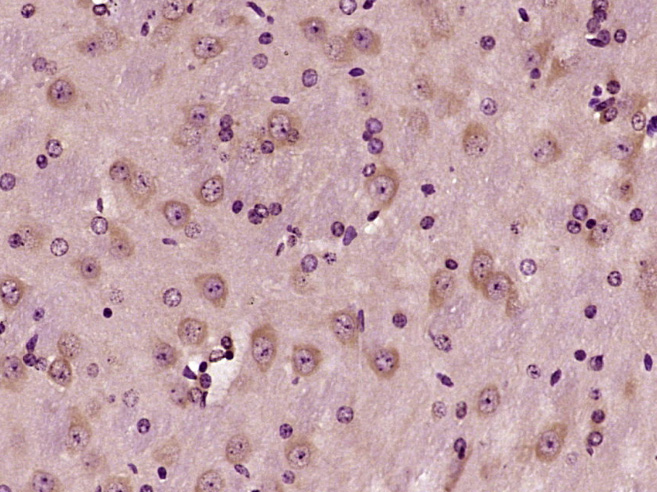 Paraformaldehyde-fixed, paraffin embedded Mouse brain; Antigen retrieval by boiling in sodium citrate buffer (pH6.0) for 15min; Block endogenous peroxidase by 3% hydrogen peroxide for 20 minutes; Blocking buffer (normal goat serum) at 37°C for 30min; Antibody incubation with DGKB Polyclonal Antibody, Unconjugated (bs-14295R) at 1:400 overnight at 4°C, DAB staining.
