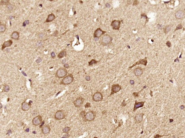 Paraformaldehyde-fixed, paraffin embedded Rat brain; Antigen retrieval by boiling in sodium citrate buffer (pH6.0) for 15min; Block endogenous peroxidase by 3% hydrogen peroxide for 20 minutes; Blocking buffer (normal goat serum) at 37°C for 30min; Antibody incubation with DGKZ Polyclonal Antibody, Unconjugated (bs-14301R) at 1:400 overnight at 4°C, DAB staining.