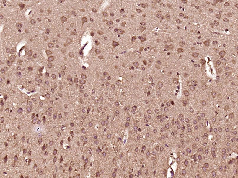 Paraformaldehyde-fixed, paraffin embedded Mouse brain; Antigen retrieval by boiling in sodium citrate buffer (pH6.0) for 15min; Block endogenous peroxidase by 3% hydrogen peroxide for 20 minutes; Blocking buffer (normal goat serum) at 37°C for 30min; Antibody incubation with DHX36 Polyclonal Antibody, Unconjugated (bs-14319R) at 1:400 overnight at 4°C, DAB staining.