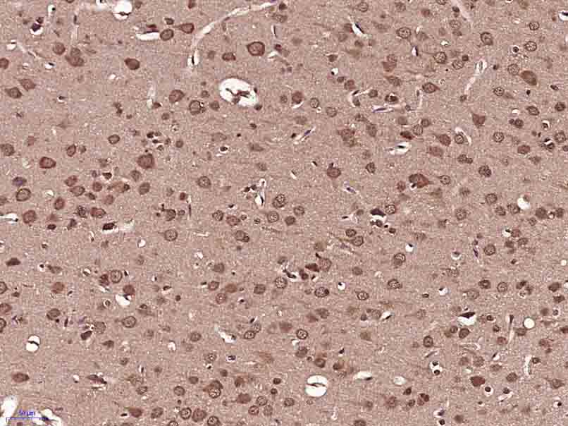 Paraformaldehyde-fixed, paraffin embedded Rat brain; Antigen retrieval by boiling in sodium citrate buffer (pH6.0) for 15min; Block endogenous peroxidase by 3% hydrogen peroxide for 20 minutes; Blocking buffer (normal goat serum) at 37°C for 30min; Antibody incubation with DIP2B Polyclonal Antibody, Unconjugated (bs-14332R) at 1:400 overnight at 4°C, DAB staining.