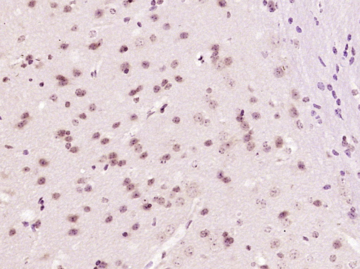 Paraformaldehyde-fixed, paraffin embedded Mouse brain; Antigen retrieval by boiling in sodium citrate buffer (pH6.0) for 15min; Block endogenous peroxidase by 3% hydrogen peroxide for 20 minutes; Blocking buffer (normal goat serum) at 37°C for 30min; Antibody incubation with DIP2B Polyclonal Antibody, Unconjugated (bs-14332R) at 1:400 overnight at 4°C, DAB staining.
