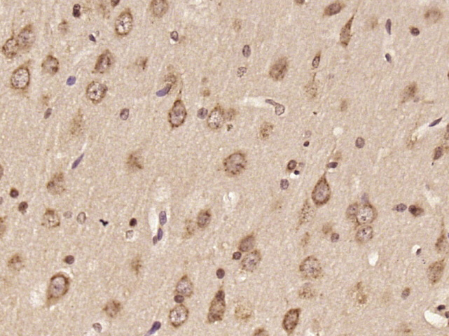 Paraformaldehyde-fixed, paraffin embedded Rat brain; Antigen retrieval by boiling in sodium citrate buffer (pH6.0) for 15min; Block endogenous peroxidase by 3% hydrogen peroxide for 20 minutes; Blocking buffer (normal goat serum) at 37°C for 30min; Antibody incubation with DNAH6 Polyclonal Antibody, Unconjugated (bs-14366R) at 1:400 overnight at 4°C, DAB staining.