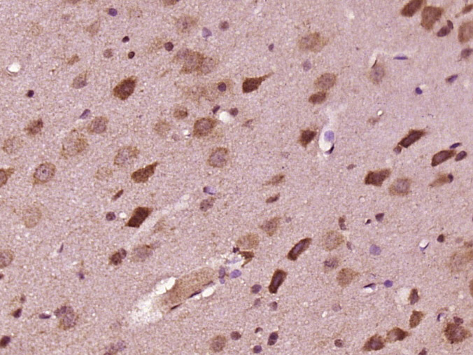 Paraformaldehyde-fixed, paraffin embedded Rat brain; Antigen retrieval by boiling in sodium citrate buffer (pH6.0) for 15min; Block endogenous peroxidase by 3% hydrogen peroxide for 20 minutes; Blocking buffer (normal goat serum) at 37°C for 30min; Antibody incubation with DND1 Polyclonal Antibody, Unconjugated (bs-14397R) at 1:400 overnight at 4°C, DAB staining.