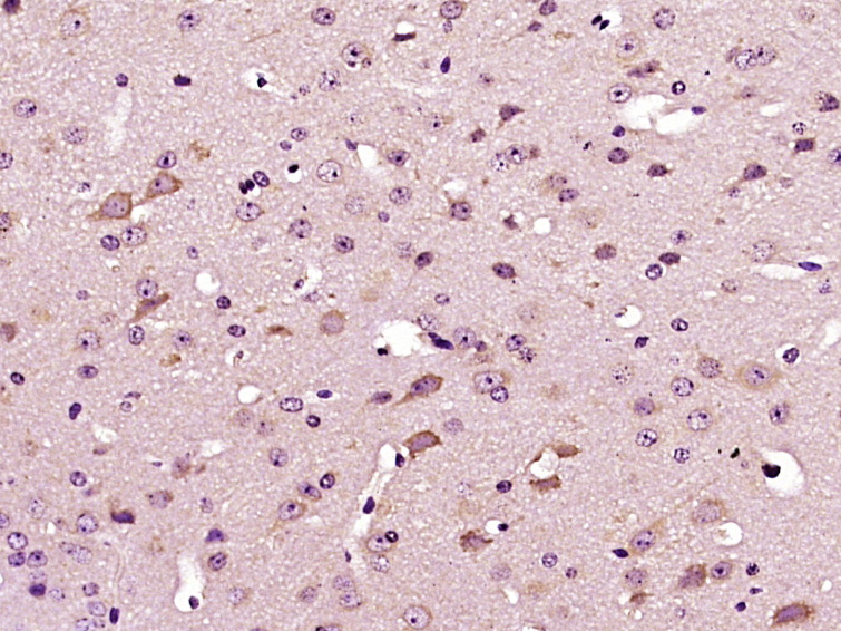 Paraformaldehyde-fixed, paraffin embedded Mouse brain; Antigen retrieval by boiling in sodium citrate buffer (pH6.0) for 15min; Block endogenous peroxidase by 3% hydrogen peroxide for 20 minutes; Blocking buffer (normal goat serum) at 37°C for 30min; Antibody incubation with DYRK4 Polyclonal Antibody, Unconjugated (bs-14474R) at 1:400 overnight at 4°C, DAB staining.