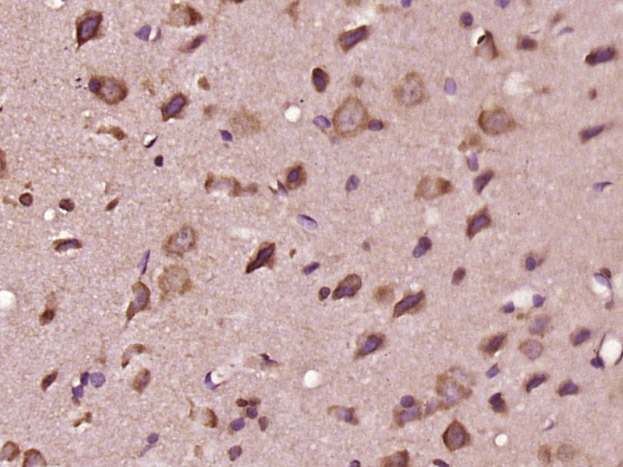 Paraformaldehyde-fixed, paraffin embedded Rat brain; Antigen retrieval by boiling in sodium citrate buffer (pH6.0) for 15min; Block endogenous peroxidase by 3% hydrogen peroxide for 20 minutes; Blocking buffer (normal goat serum) at 37°C for 30min; Antibody incubation with EDEM3 Polyclonal Antibody, Unconjugated (bs-14502R) at 1:400 overnight at 4°C, DAB staining.