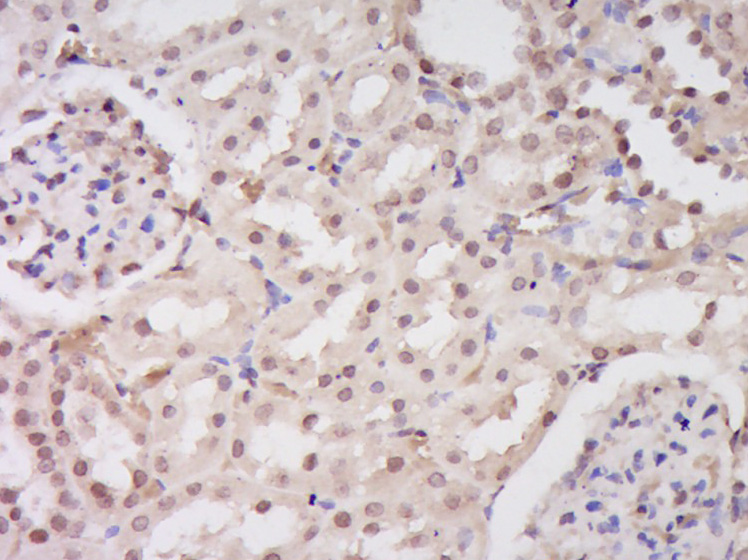 Paraformaldehyde-fixed, paraffin embedded Rat kidney; Antigen retrieval by boiling in sodium citrate buffer (pH6.0) for 15min; Block endogenous peroxidase by 3% hydrogen peroxide for 20 minutes; Blocking buffer (normal goat serum) at 37°C for 30min; Antibody incubation with EEFSEC Polyclonal Antibody, Unconjugated (bs-14505R) at 1:400 overnight at 4°C, DAB staining.