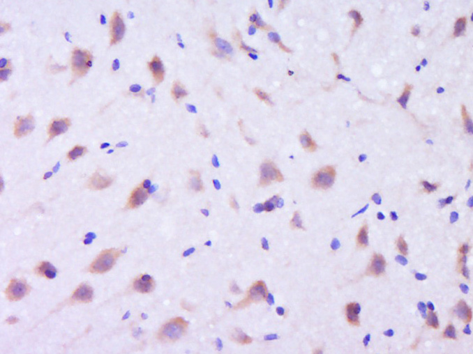 Paraformaldehyde-fixed, paraffin embedded Rat brain; Antigen retrieval by boiling in sodium citrate buffer (pH6.0) for 15min; Block endogenous peroxidase by 3% hydrogen peroxide for 20 minutes; Blocking buffer (normal goat serum) at 37°C for 30min; Antibody incubation with EFR3B Polyclonal Antibody, Unconjugated (bs-14521R) at 1:400 overnight at 4°C, DAB staining.