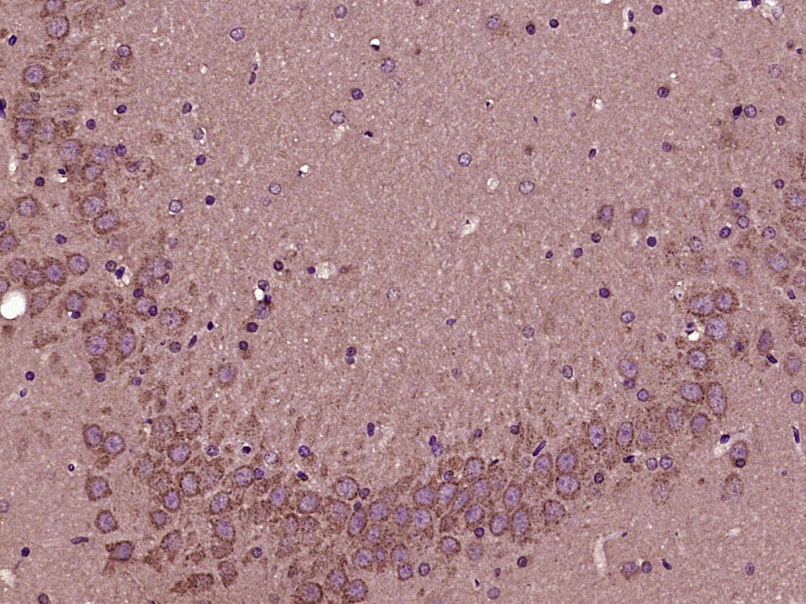 Paraformaldehyde-fixed, paraffin embedded Rat brain; Antigen retrieval by boiling in sodium citrate buffer (pH6.0) for 15min; Block endogenous peroxidase by 3% hydrogen peroxide for 20 minutes; Blocking buffer (normal goat serum) at 37°C for 30min; Antibody incubation with eIF4A2 Polyclonal Antibody, Unconjugated (bs-14549R) at 1:400 overnight at 4°C, DAB staining. Paraformaldehyde-fixed, paraffin embedded Rat brain; Antigen retrieval by boiling in sodium citrate buffer (pH6.0) for 15min; Block endogenous peroxidase by 3% hydrogen peroxide for 20 minutes; Blocking buffer (normal goat serum) at 37°C for 30min; Antibody incubation with eIF4A2 Polyclonal Antibody, Unconjugated (bs-14549R) at 1:400 overnight at 4°C, DAB staining.