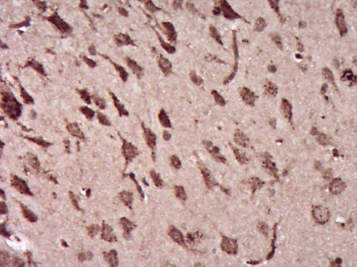 Paraformaldehyde-fixed, paraffin embedded Rat brain; Antigen retrieval by boiling in sodium citrate buffer (pH6.0) for 15min; Block endogenous peroxidase by 3% hydrogen peroxide for 20 minutes; Blocking buffer (normal goat serum) at 37°C for 30min; Antibody incubation with Ermin Polyclonal Antibody, Unconjugated (bs-14626R) at 1:400 overnight at 4°C, DAB staining.