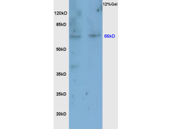 Rat brain lysates probed with Anti Nrf2 Polyclonal Antibody, Unconjugated (bs-1074R) at 1:200 overnight at 4˚C. Followed by conjugation to secondary antibody (bs-0295G-HRP) at 1:3000 for 90 min at 37˚C. Predicted band 66kD. Observed band size:66kD.\\n